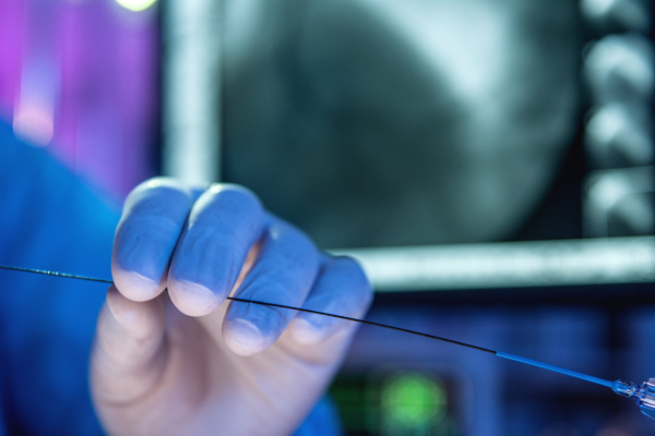 pose de stents et retour à la norme