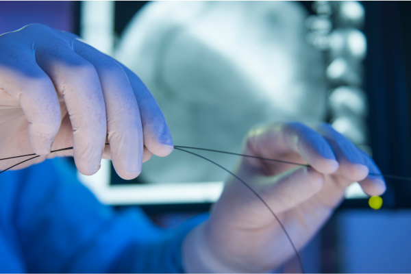 espérance de vie avec des stents