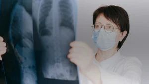 Médecin examinant une radiographie du thorax
