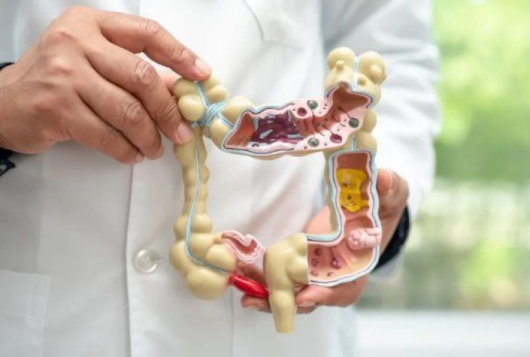 diverticule cause émotionnelle