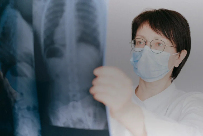 Médecin examinant une radiographie du thorax