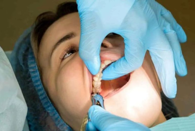 remède de grand-mère après extraction dent